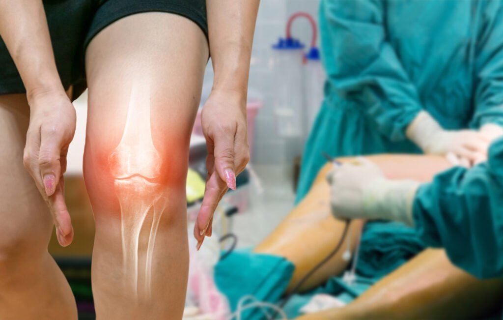 Total Knee Replacement